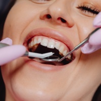 Dentisterie holistique, préventive et sans métal