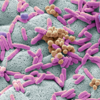 Nos divers microbiotes. Celui du cerveau est identique à celui de l’intestin. D’où son importance ! C’est notre identité. Comment le réparer et l’entretenir ?